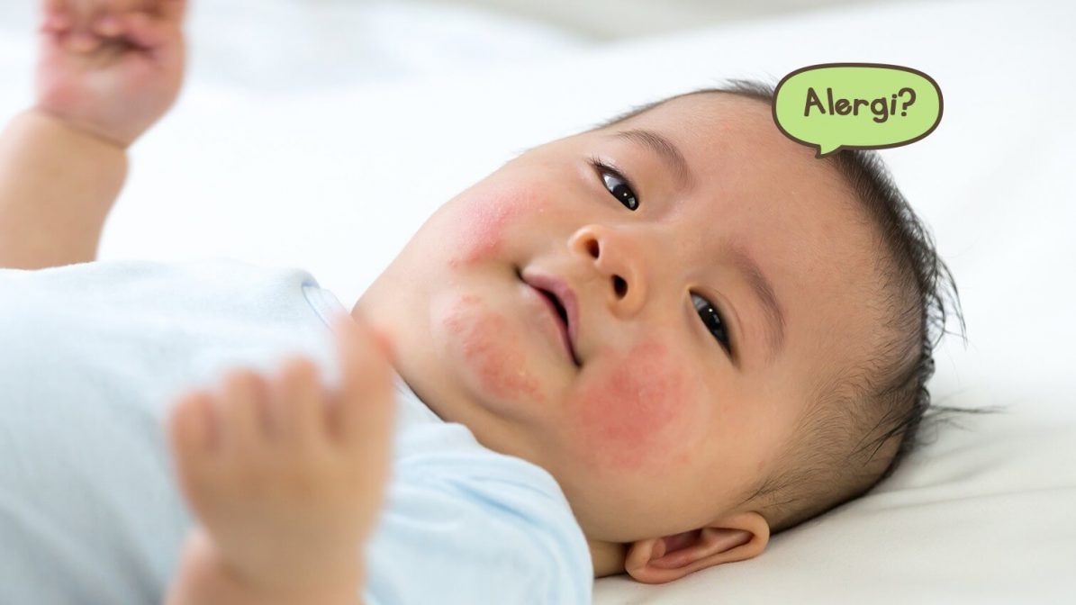 Penyebab Alergi Pada Anak 