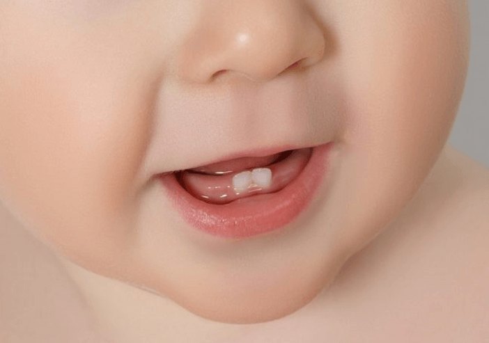 Gigi Tumbuh Pada Bayi