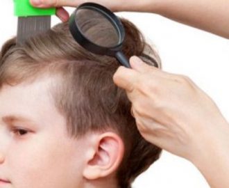 Wah Ada  Kutu  Rambut  Pada Anak  Berikut 5 Cara Membasminya 