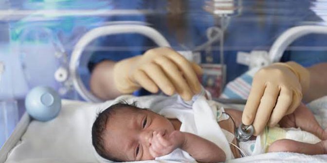 perawatan bayi prematur