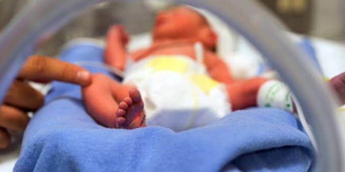 8 Tips Perawatan Bayi Prematur, Sesuai Prosedur Kesehatan 1