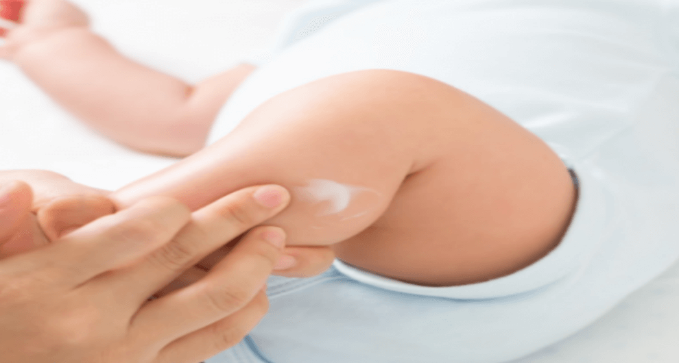 Perawatan Kulit Bayi Sensitif