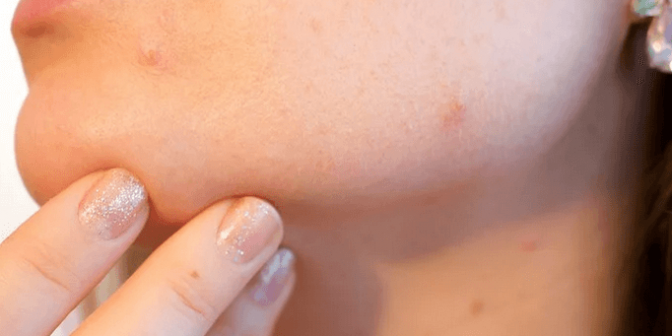 alergi kulit saat hamil
