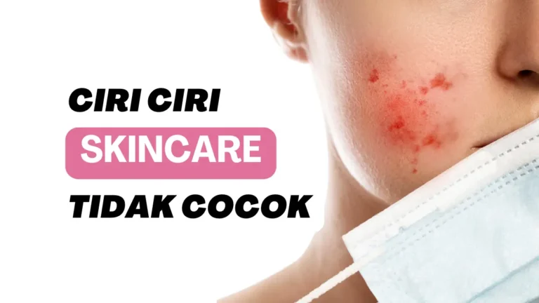 Ciri Ciri Skincare Tidak Cocok