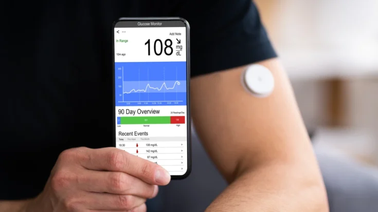 Get to Know Continuous Glucose Monitoring 2