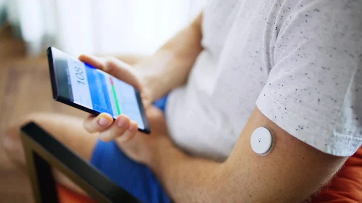 Get to Know Continuous Glucose Monitoring 3