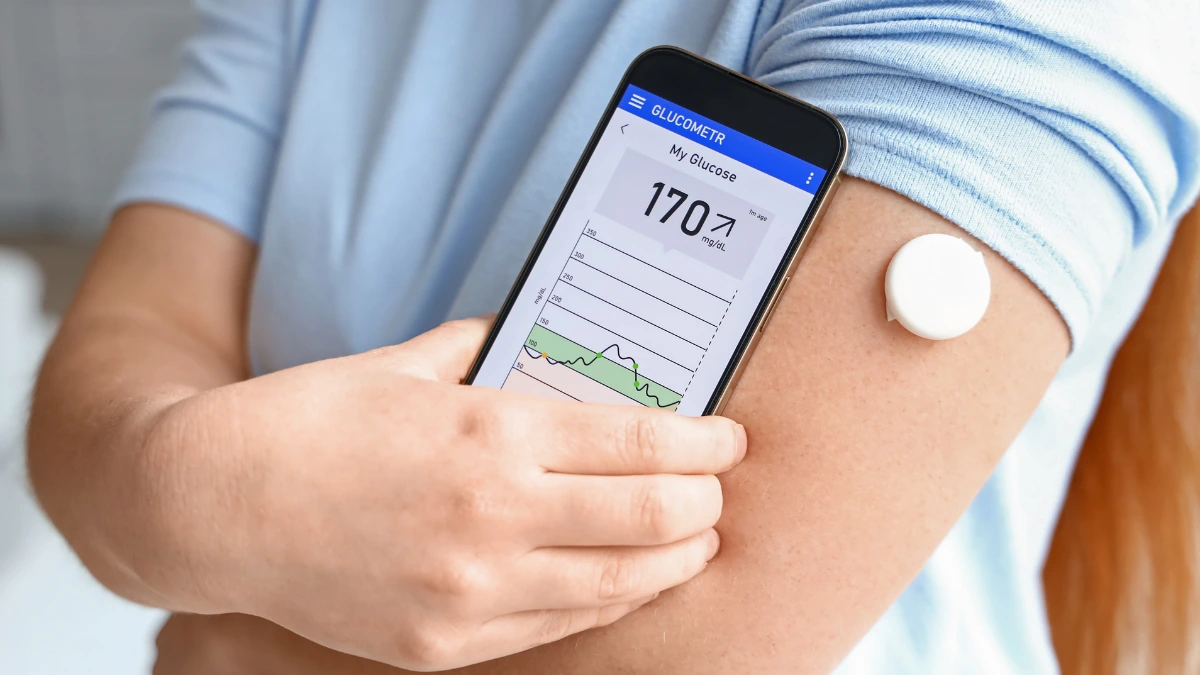 Get to Know Continuous Glucose Monitoring