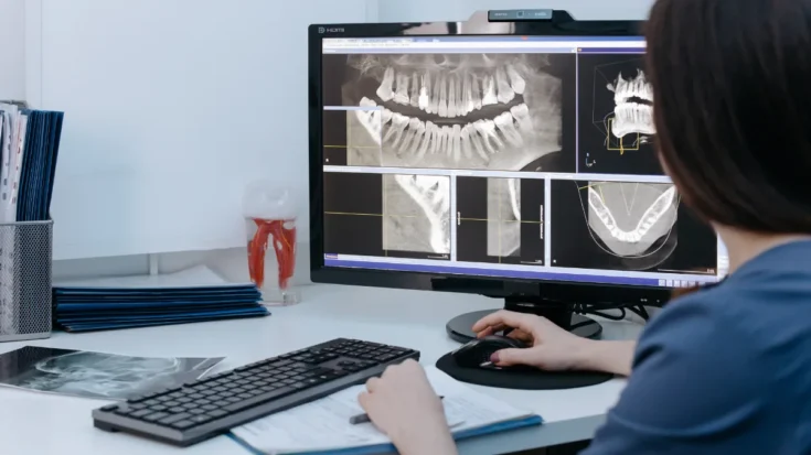 Digital Radiography Definition, How it Works, Benefits, and the Regulations in Indonesia 2