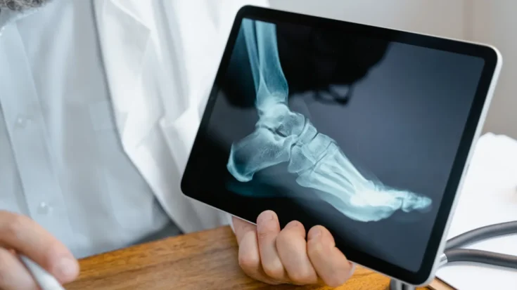 Digital Radiography Definition, How it Works, Benefits, and the Regulations in Indonesia 3