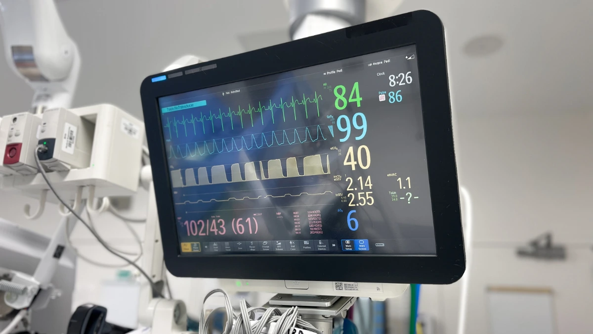 The 8 Types of Electrocardiogram That You Need to Know