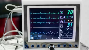 Multi-Parameter Monitor Definition, Functions, and Advantages